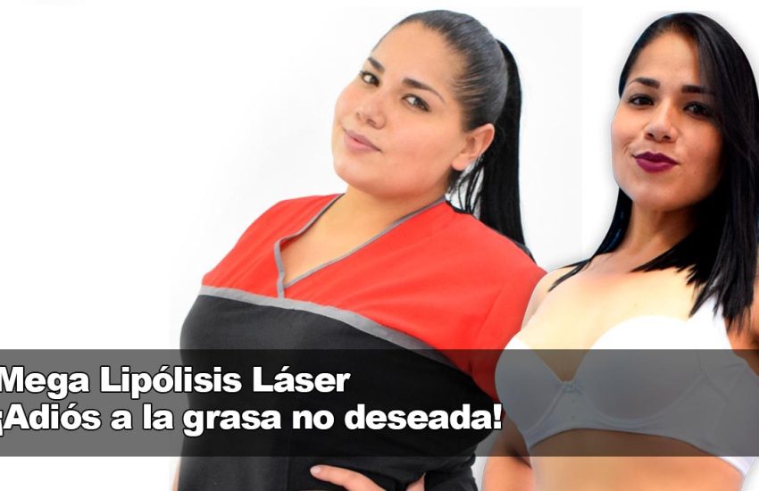 Mega Lipolisis Laser ¡Adios a la grasa no deseada